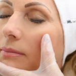 Botox